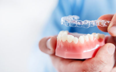 ¿Cuánto tiempo dura un tratamiento con Invisalign®?