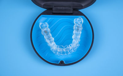 Invisalign® Express; la solución de los casos leves