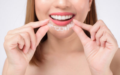 ¿Por qué se cambian los alineadores Invisalign® cada 15 días?