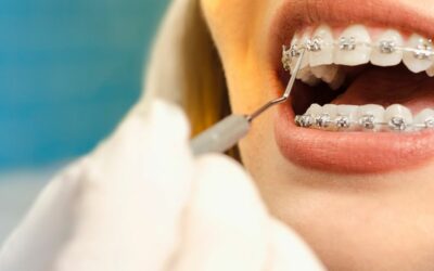 ¿Los brackets dan dolor de oídos? Entérate aquí